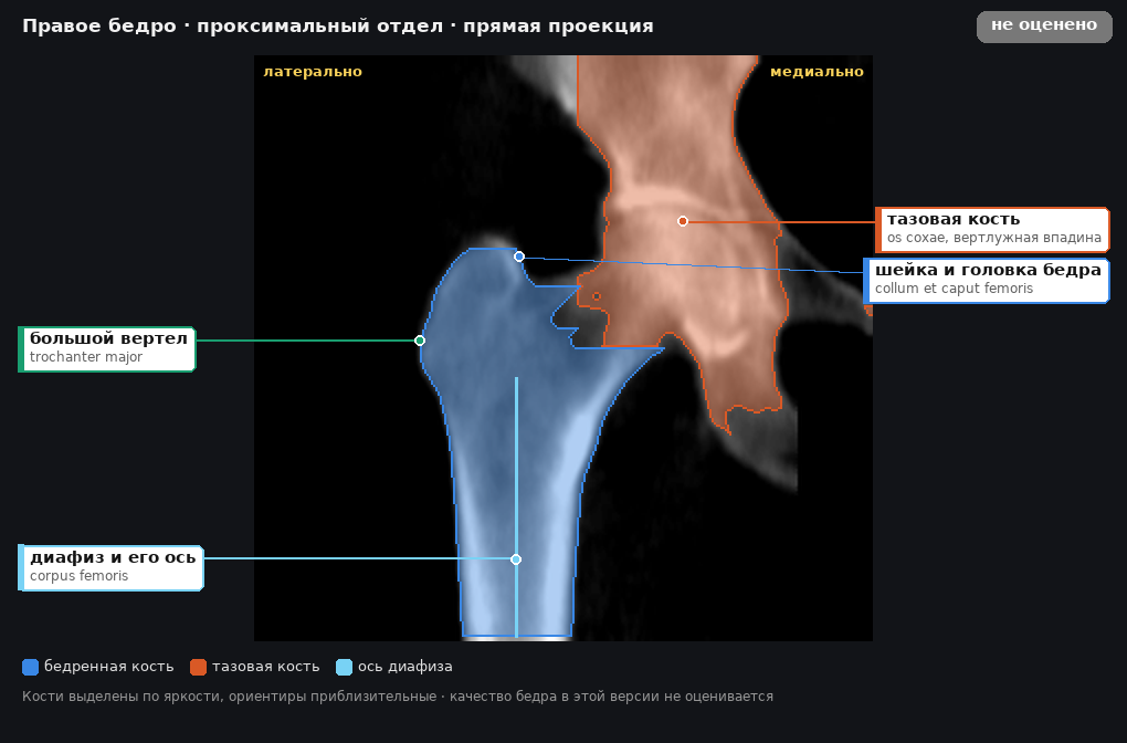 атлас: правое бедро