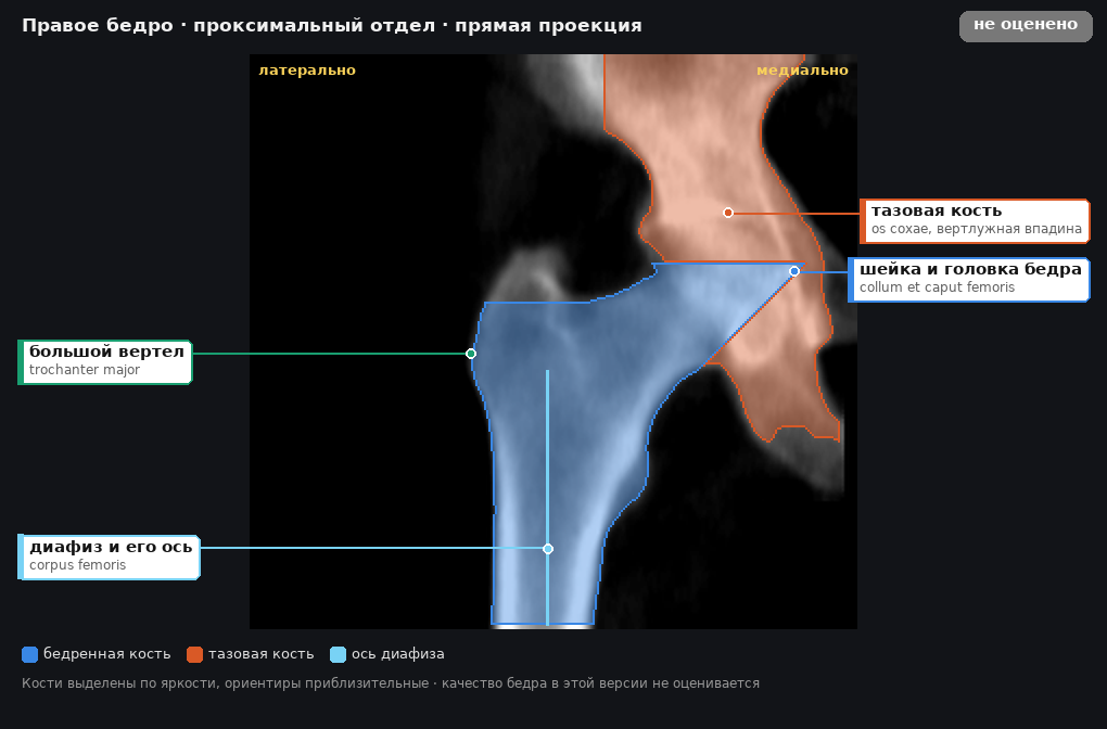 разметка снимка в стиле атласа