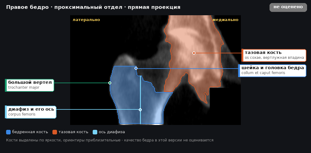 атлас: правое бедро