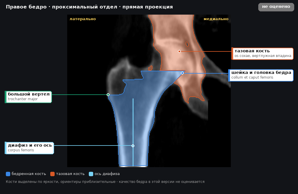 атлас: правое бедро