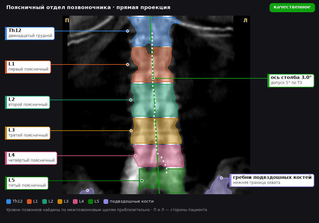 разметка снимка в стиле атласа