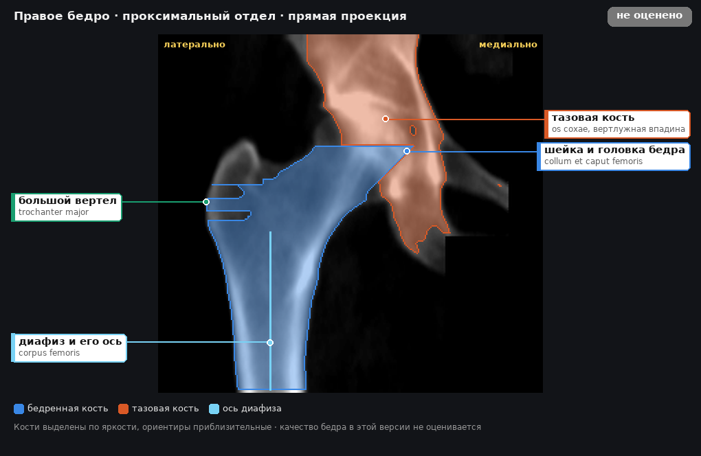 атлас: правое бедро