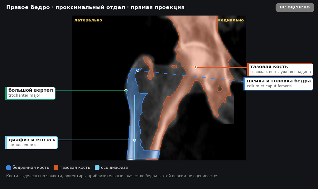 разметка снимка в стиле атласа