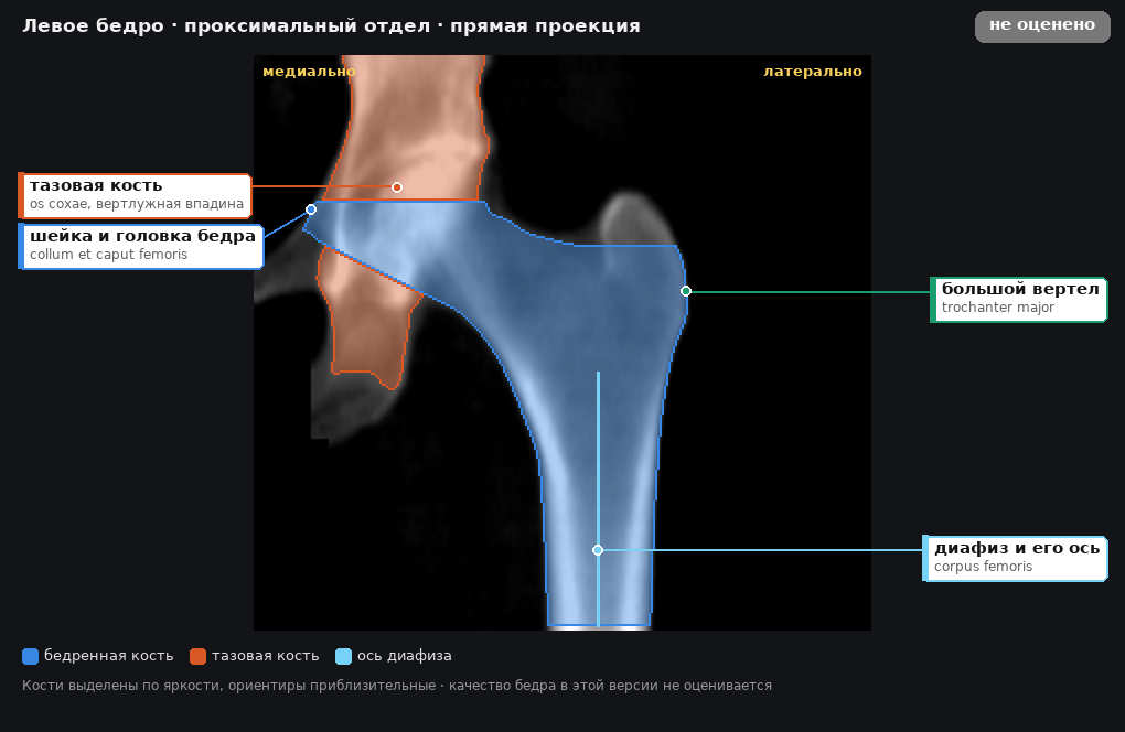 разметка снимка в стиле атласа
