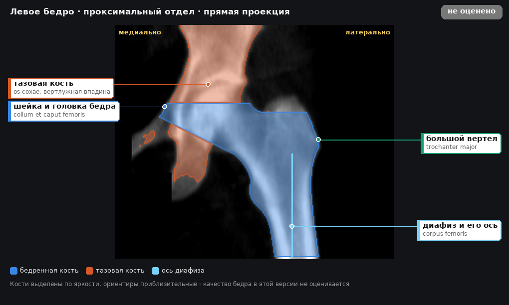 атлас: левое бедро