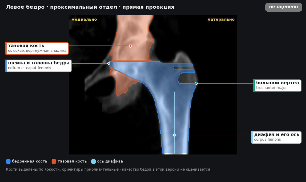разметка снимка в стиле атласа