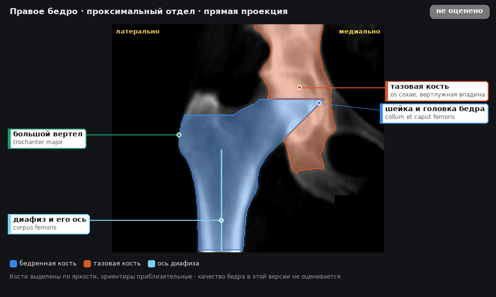 атлас: правое бедро