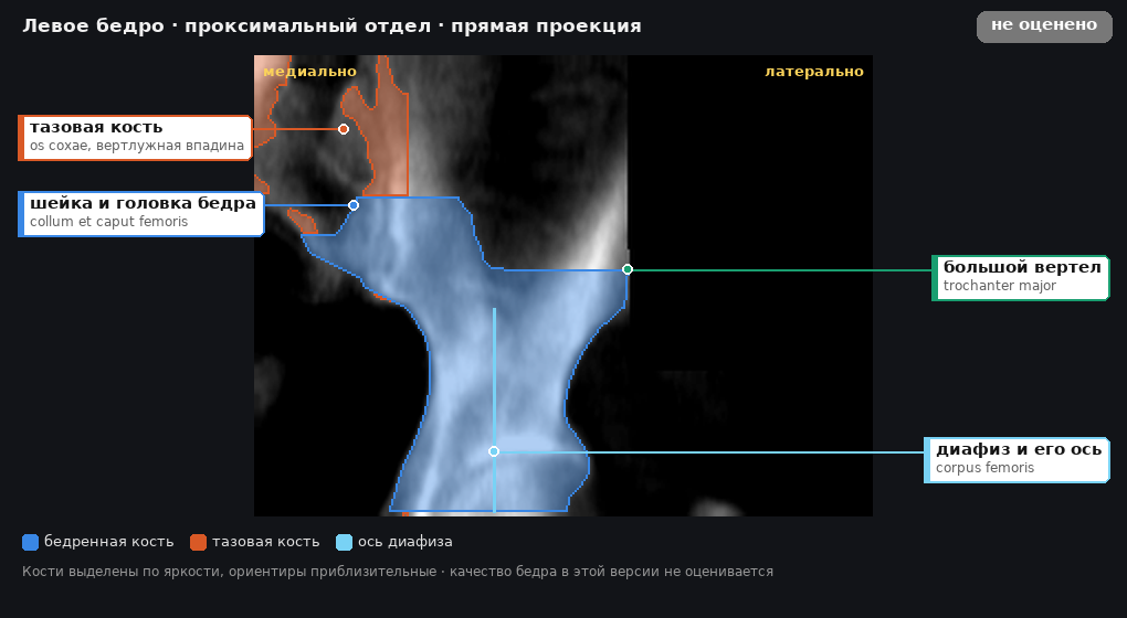 атлас: левое бедро