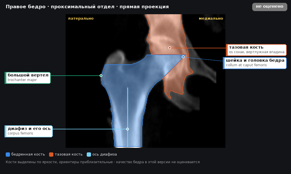 атлас: правое бедро