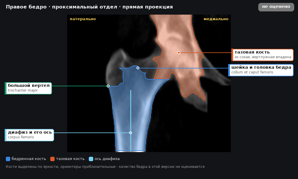 атлас: правое бедро