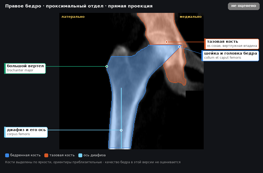 атлас: правое бедро