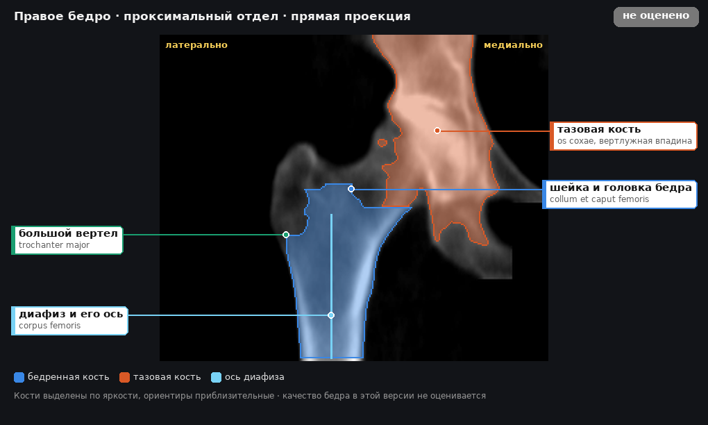 атлас: правое бедро