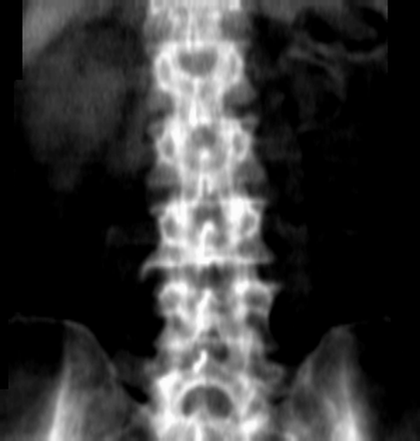 исходный снимок