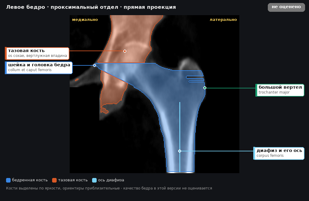 разметка снимка в стиле атласа