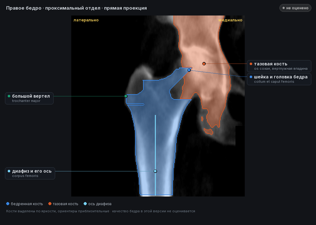 атлас: правое бедро