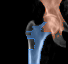 разметка снимка