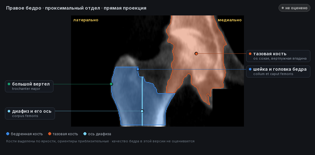 атлас: правое бедро