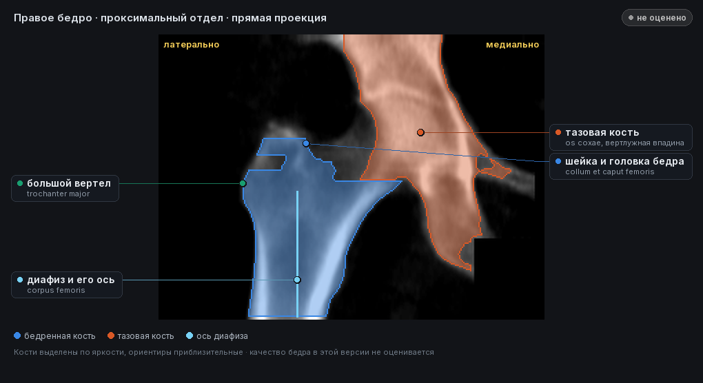 атлас: правое бедро