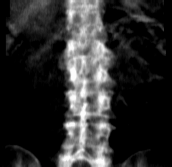 исходный снимок