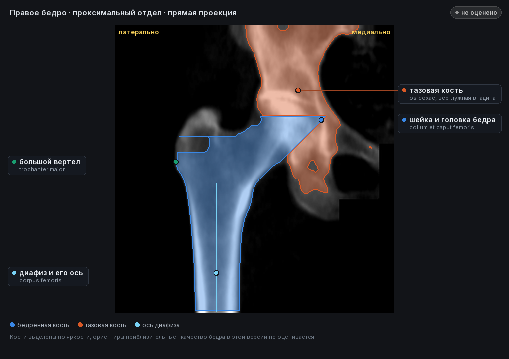 атлас: правое бедро