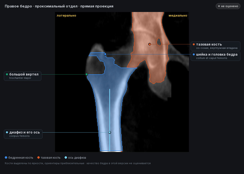 разметка снимка в стиле атласа