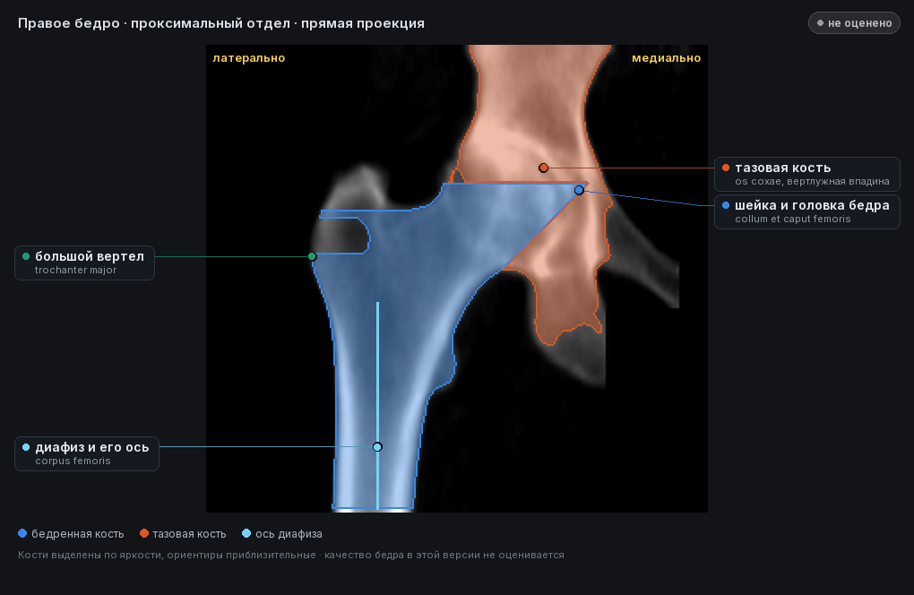 разметка снимка в стиле атласа