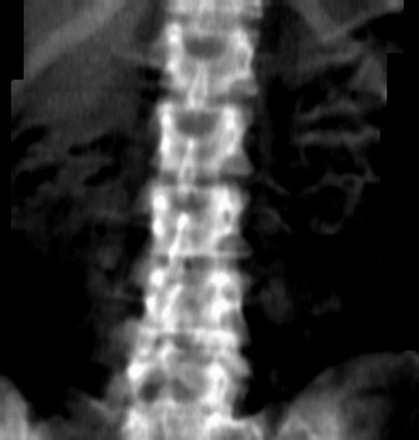 исходный снимок