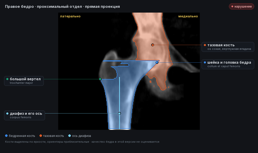 атлас: правое бедро