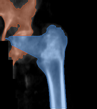разметка снимка
